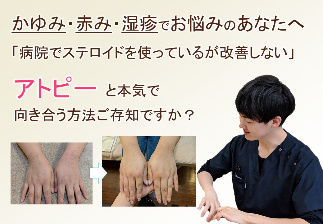 大阪市西成区のアトピー性皮膚炎の専門施術ならオルソ鍼灸院 大阪でアトピー 頭痛 自律神経の不調ならオルソ鍼灸院